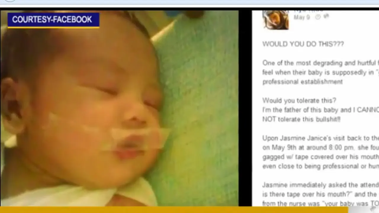 Perawat Solasi Bibir Bayi Baru Lahir karena Menangis Kencang