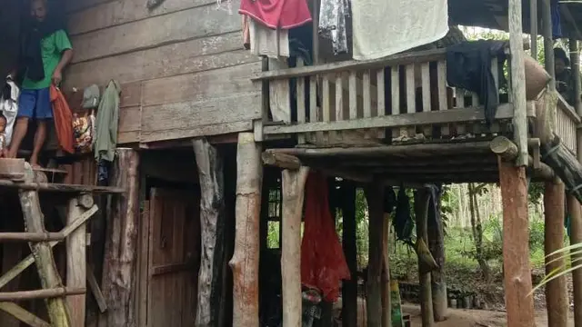 Gizi Buruk Hantui Penyandang Disabilitas di Kecamatan Termiskin di Musi Banyuasin
