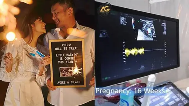 [Fimela] Adiezty Fersa dan Gilang Dirga