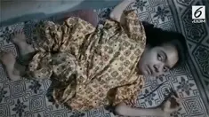 Seorang wanita di India mengalami kelianan tulang, tulangnya terus menyusut sehingga bentuk tubuhnya berubah.