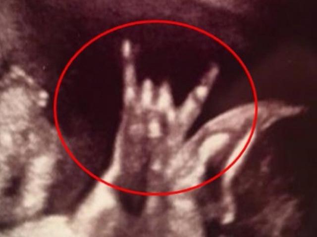 Fenomenal Foto Usg Janin Bergaya Rock Bikin Netizen Melongo Citizen6 Liputan6 Com