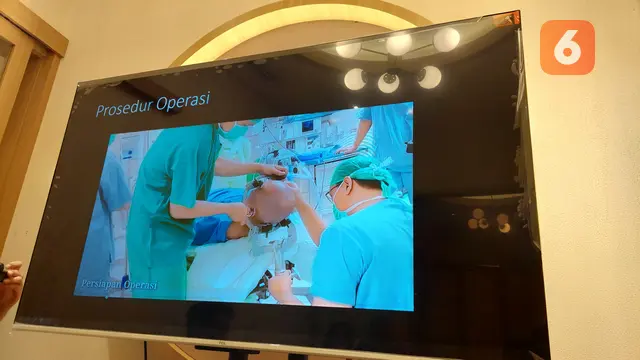 Operasi Parkinson Umum Meliputi Stereotactic Brain Lesioning dan Deep Brain Stimulation (DBS), Membantu Pasien Mengendalikan Gejala yang Sulit Ditangani Obat (Foto: Aditya Eka Prawira/Liputan6.com)