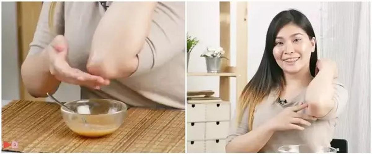 Cara Mencerahkan Lutut dan Siku Tanpa Lotion Pemutih