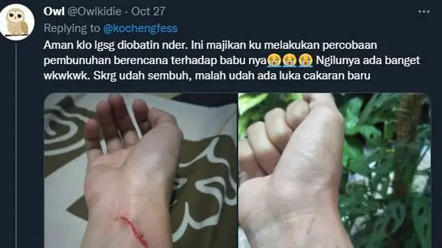 7 Potret Ulah Kucing Bandel Cakar Majikan Ini Bikin Ngilu