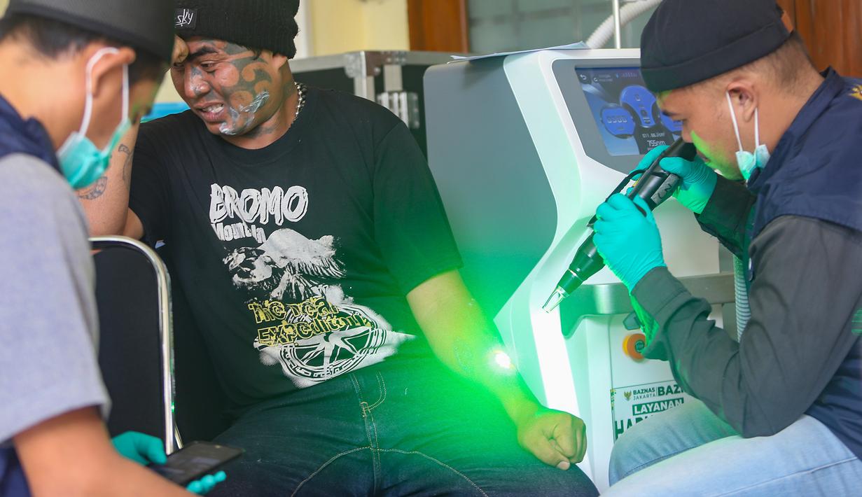 Petugas melakukan proses hapus tato pada tubuh peserta di Masjid Sunda Kelapa, Jakarta, Selasa (24/2/2026). Sejak pertama kali dilaksanakan, ribuan orang telah mendapat manfaat dari program hapus tato gratis yang digelar Badan Amil Zakat Nasional (Baznas)/Bazis Provinsi DKI Jakarta. (merdeka.com/Arie Basuki)