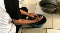 Kusta Berujung Disabilitas, Apa Bedah Plastik Rekonstruksi Bisa Jadi Solusi?