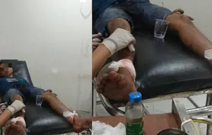 Dibacok Tetangga, Pria di Lampung Alami Luka Sekujur Tubuh
