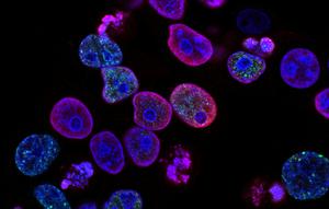 Ilustrasi Sel Kanker (Foto: National Cancer Institute/Unsplash)