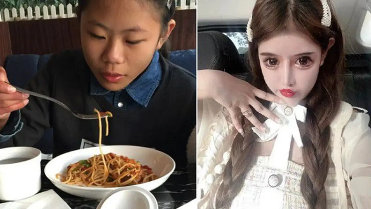 Gadis 16 Tahun Ini Telah Jalani Operasi Plastik Hingga 100 Kali, Habiskan Biaya Total Rp 8 M