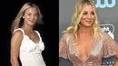 Kaley Cuoco engaku dirinya melakukan operasi plastik untuk hidungnya, memperbesar payudara dan fillers. (Rex/Shutterstock/HollywoodLife)