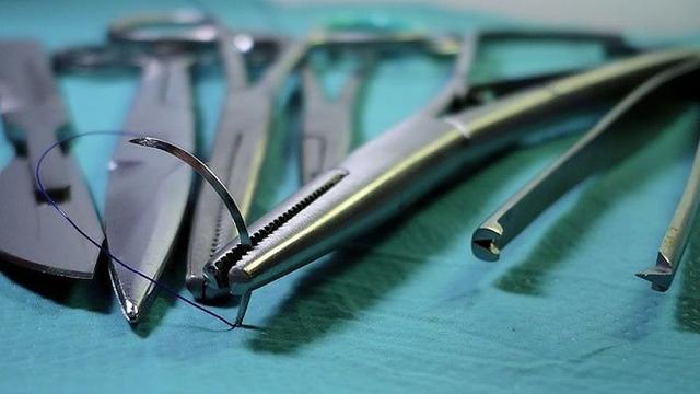 Benang Jahit Luka (Sumber: Bobo.grid.id)