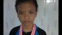 Abednego Putra Timotius Parulian Napitupulu adalah seorang anak laki-laki dengan Retardasi Mental Sedang (RM) yang masuk dalam kekhususan Tunagrahita. Foto: dokumen pribadi Abednego.