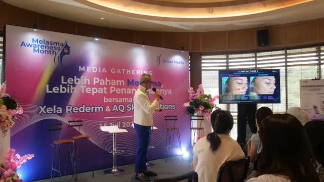 Selain Burnout, Perempuan Usia Produktif Juga Rentan Mengalami Melasma