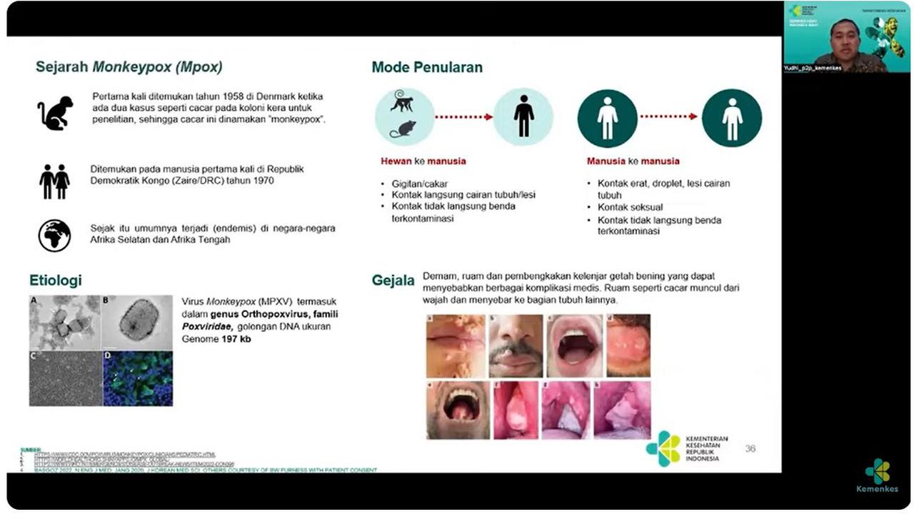 Indonesia Siap Hadapi Mpox, Kemenkes Perketat Pengawasan di Perbatasan (Tangkapan Layar dari Temu Media : Update Mpox di Indonesia/Youtube Kemenkes RI)
