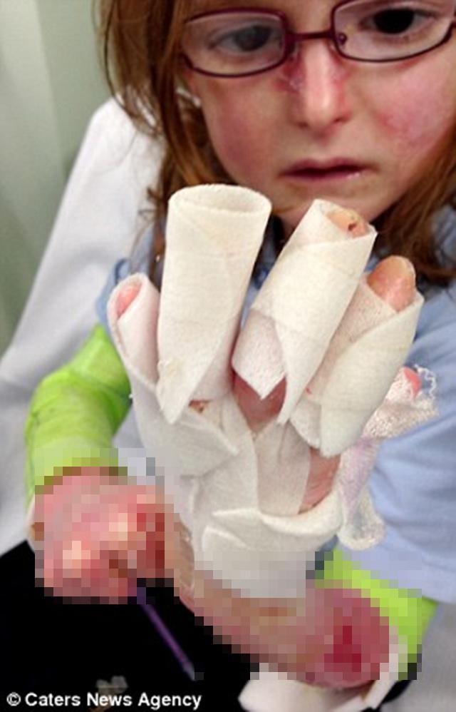 Isla | Photo: Copyright dailymail.co.uk 