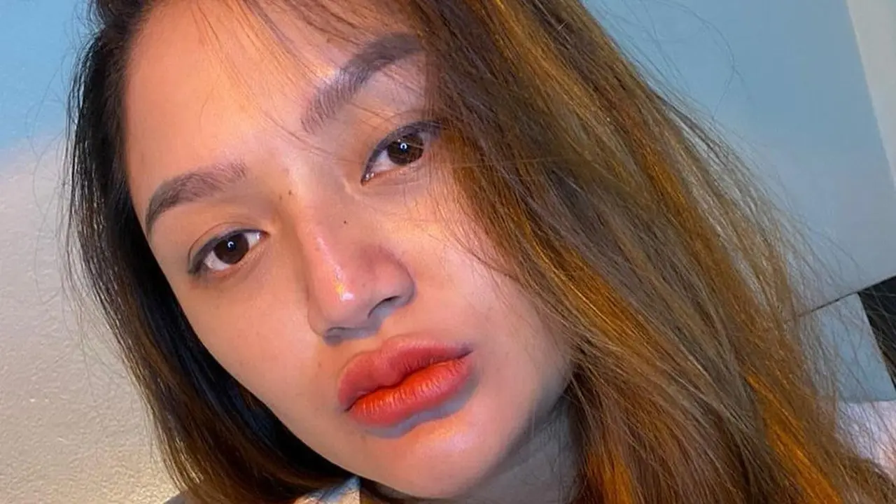 Jelang Lahiran, Ini 6 Potret Kondisi Terbaru Siti Badriah yang Positif Omicron