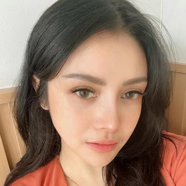 Habiskan Rp 521 Juta Untuk Oplas, Ini 6 Potret Terbaru Mawar AFI Bikin Pangling