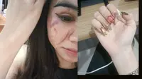 Bella Alias Ali Dilabrak Sesama Waria Gara-Gara Ucapan 'Wandu', Kukunya sampai Copot