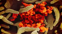 Gambar menggunakan mikroskop elektron yang tak bertanggal pada Februari 2020 menunjukkan virus corona SARS-CoV-2 (oranye) muncul dari permukaan sel (hijau) yang dikultur di laboratorium.  Sampel virus dan sel diambil dari seorang pasien yang terinfeksi COVID-19. (NIAID-RML via AP)