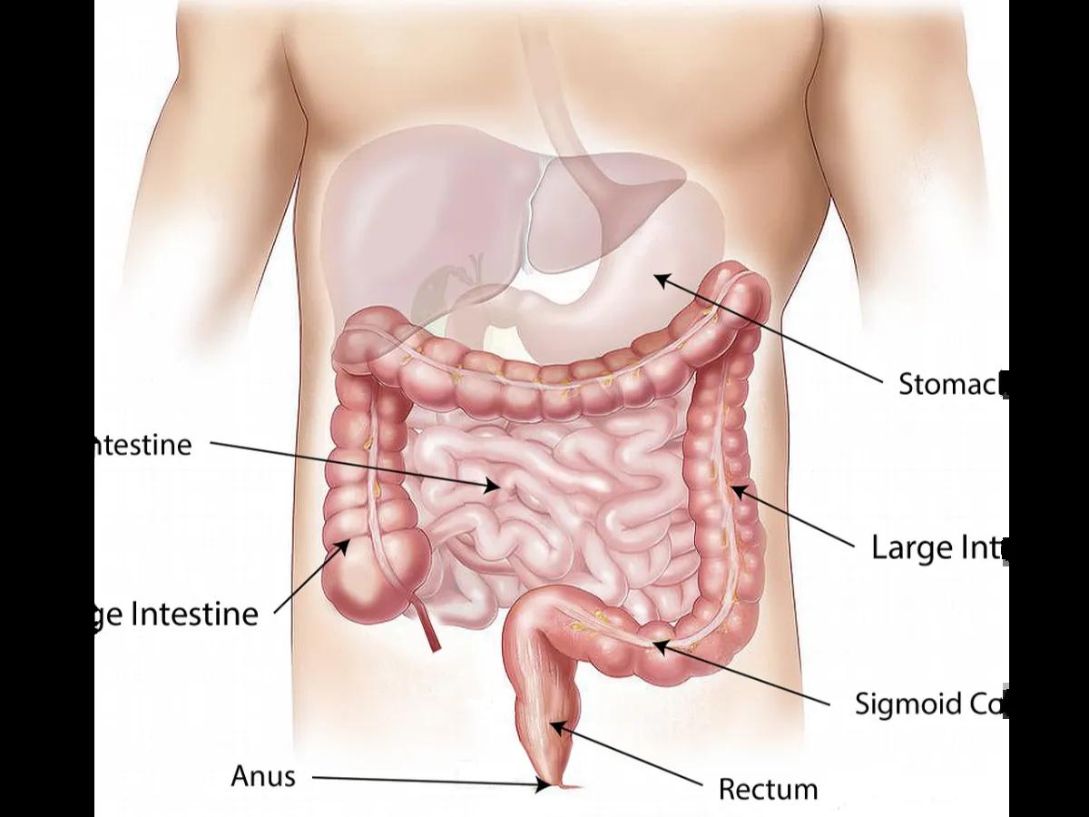 Antraks Gastrointestinal