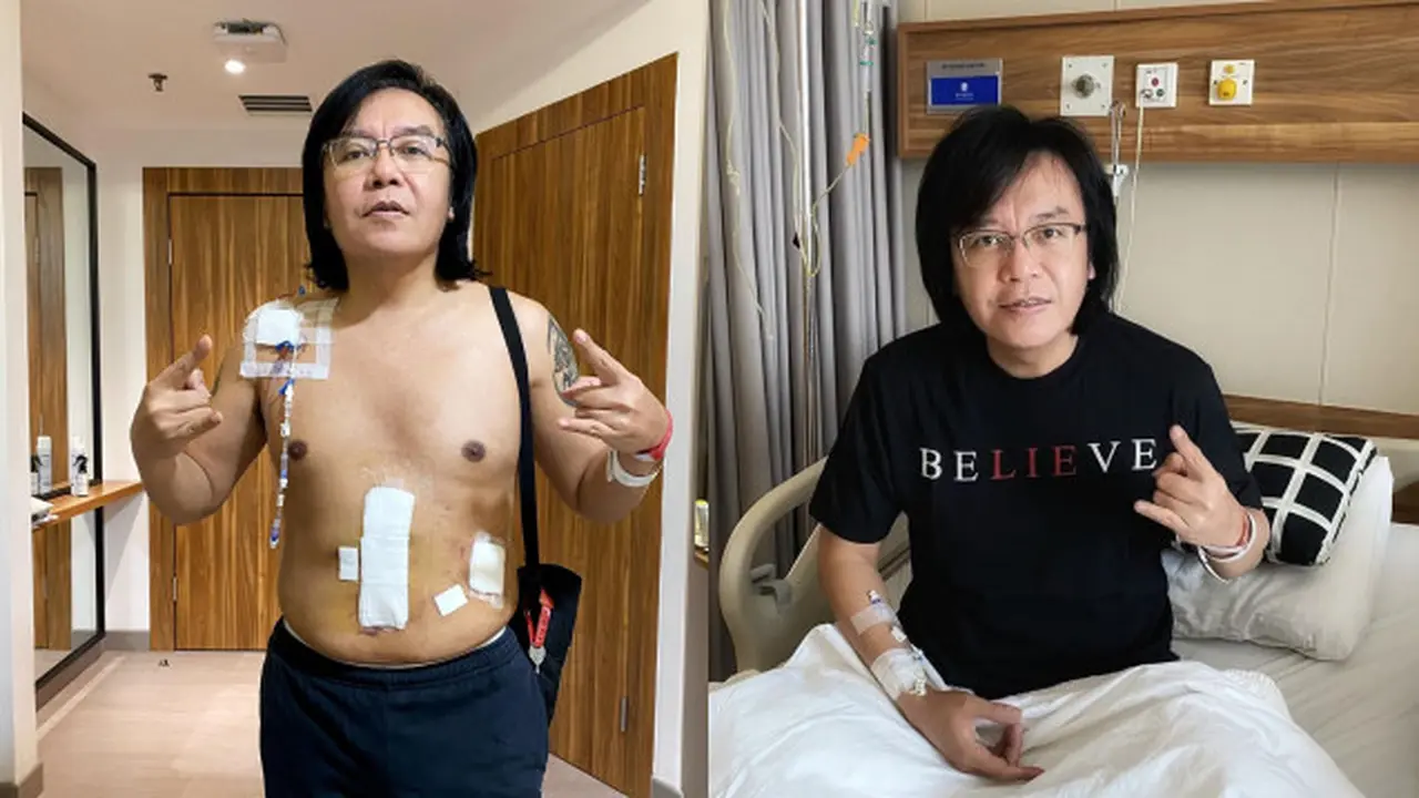 Potret Terbaru Ari Lasso Pasca Operasi Pengangkatan Tumor Perut, Sudah Bisa Pulang