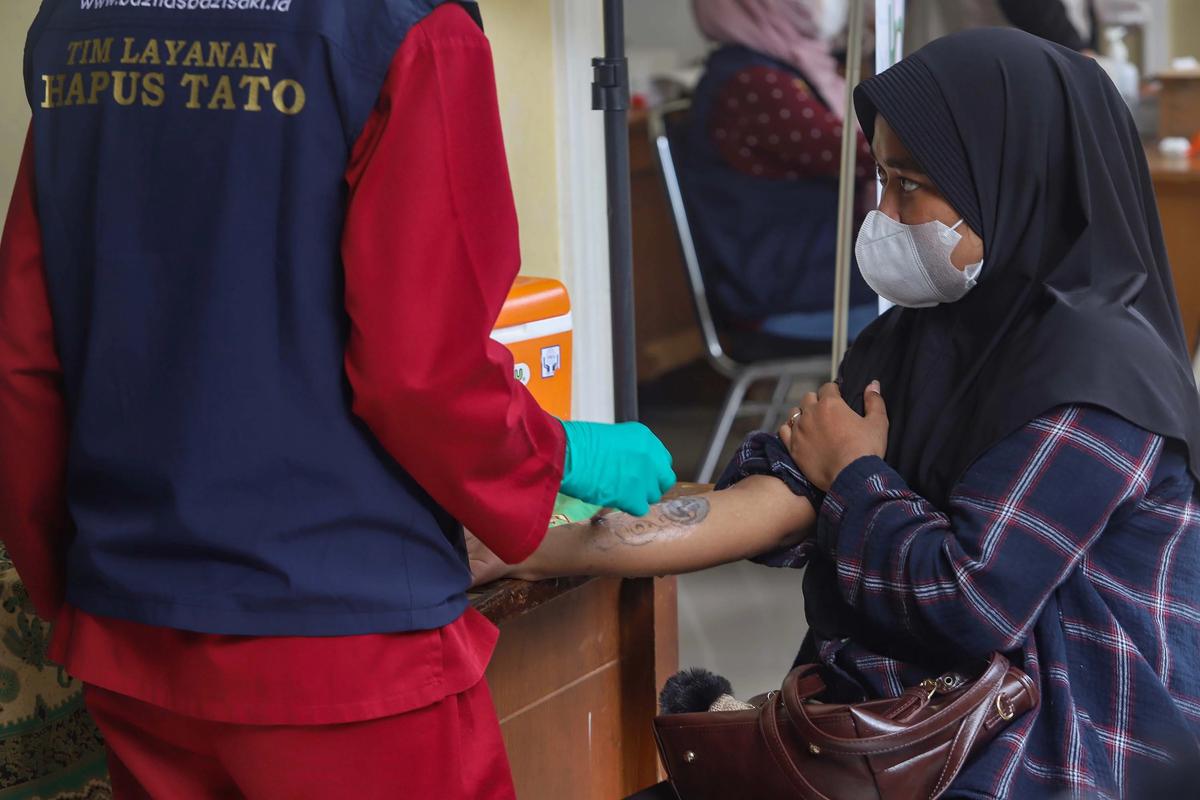 FOTO: Layanan Hapus Tato Gratis Sambut Ramadhan di Jakarta