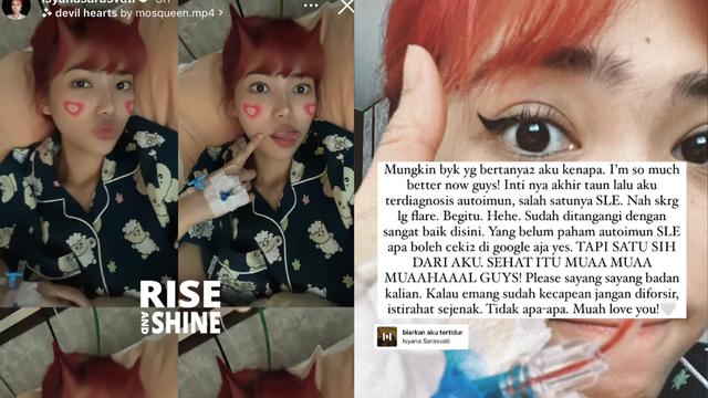 Isyana Sarasvati bagikan kabar terbaru soal kondisi kesehatannya. Dirinya didiagnosis terkena Autoimun SLE atau lupus.