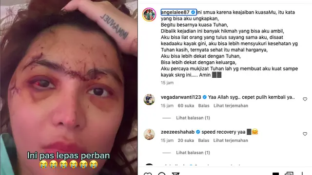 Ngeri, Angela Lee Ceritakan Kronologi Kecelakaan yang Hampir Merenggut Nyawanya. (instagram.com/angelalee87)