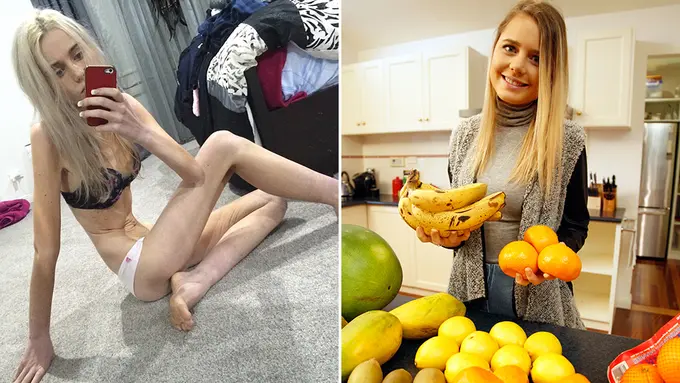 Demi Kepopuleran, Gadis Ini Hampir Kehilangan Nyawanya