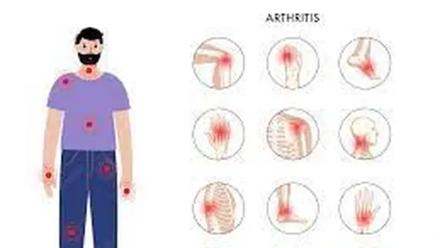 Ilustrasi Fibromyalgia (sumber: freepik)