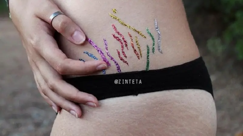 Intip Uniknya Tato Stretchmark Warna-Warni