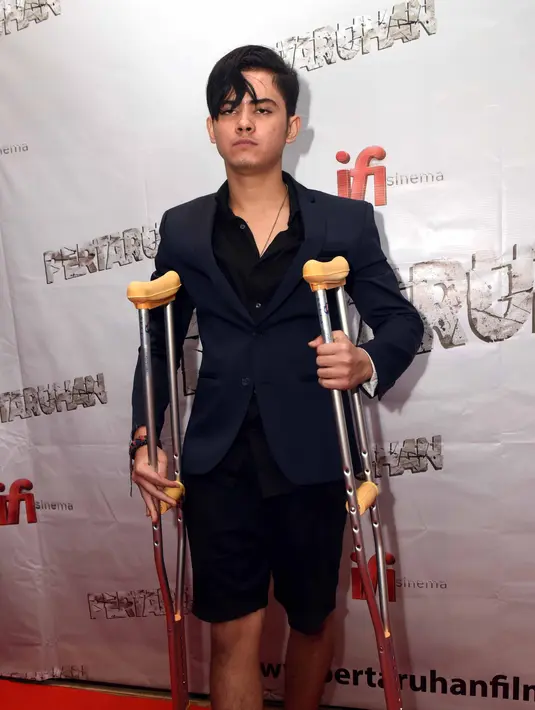 Saat sedang berenang, ia melompat dan kakinya kebentur lantai yang gompal. Akibatnya, banyak darah mengucur hingga membuat panik. (Nurwahyunan/Bintang.com)