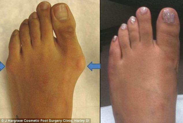 Foto: Copyright DailyMail.co.uk