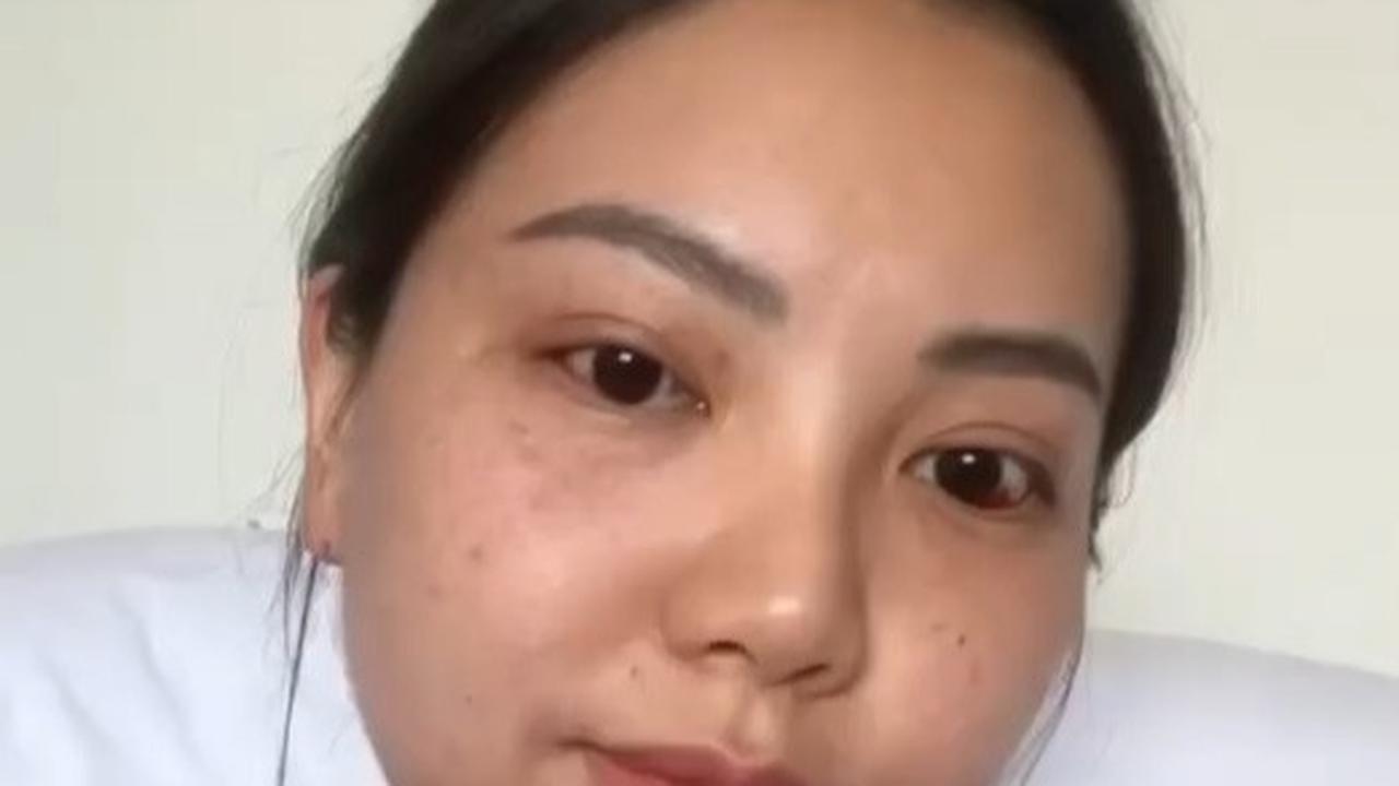 YouTuber dan pengusaha Tya Magdalena dikabarkan sempat mengalami pecah pembuluh darah saat melahirkan. Perempuan yang akrab dipanggil Pao Pao ini mengalami pecah pembuluh darah lantaran diduda salah mengejan.
