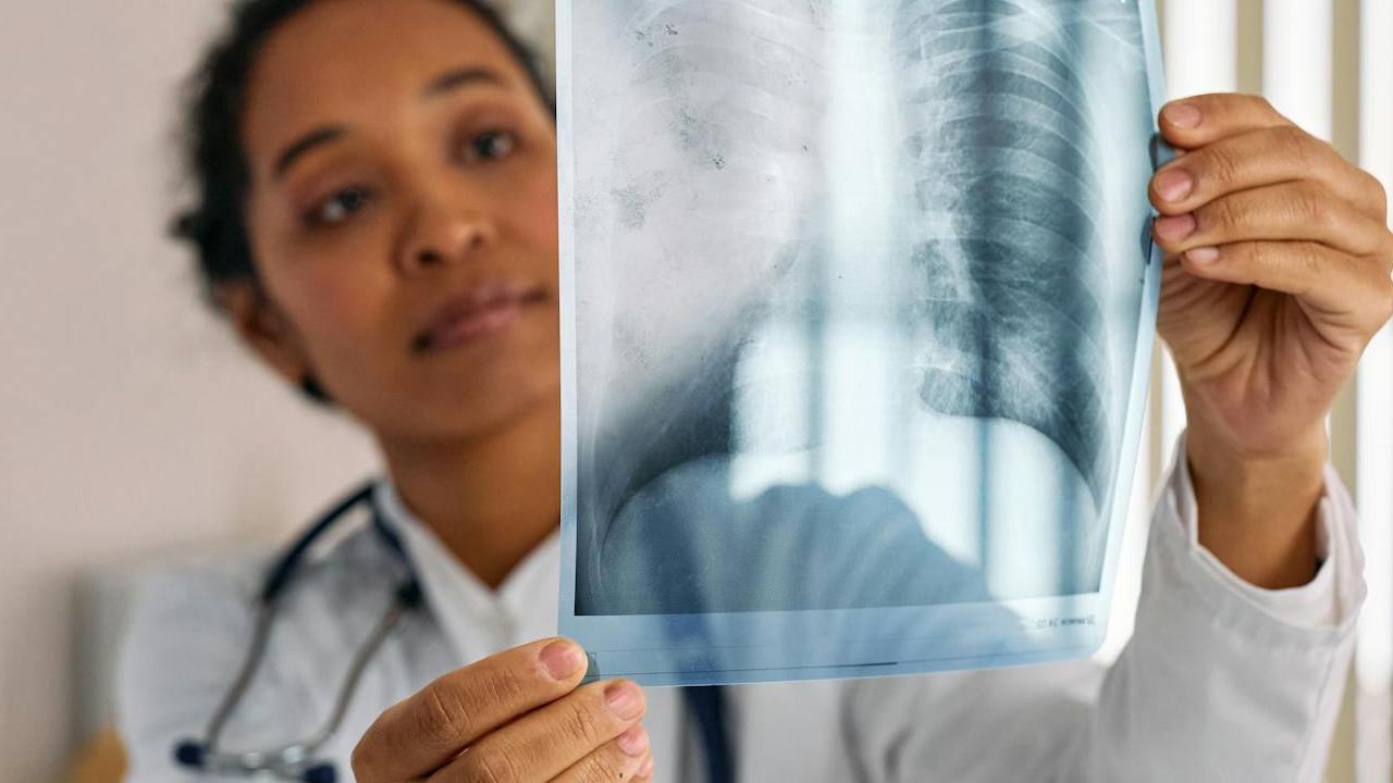 ilustrasi penyakit pneumonia