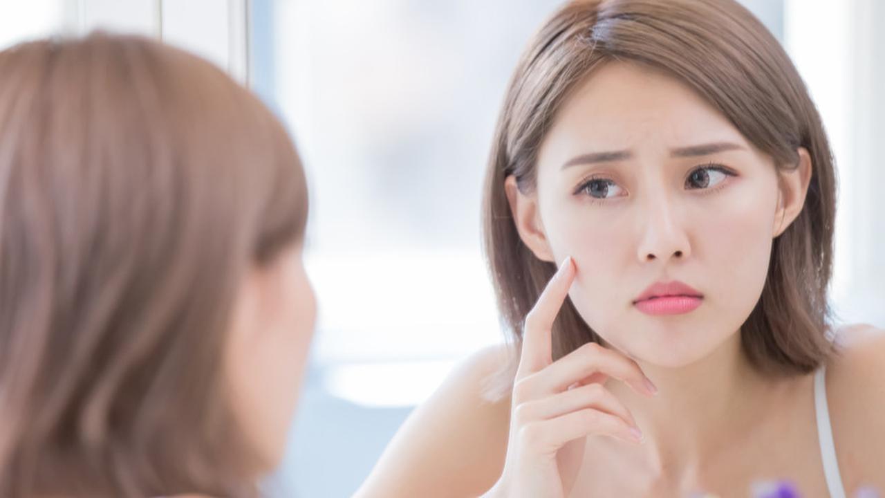 4 Kandungan Andalan dalam Skincare untuk Mengatasi Flek Hitam Membandel