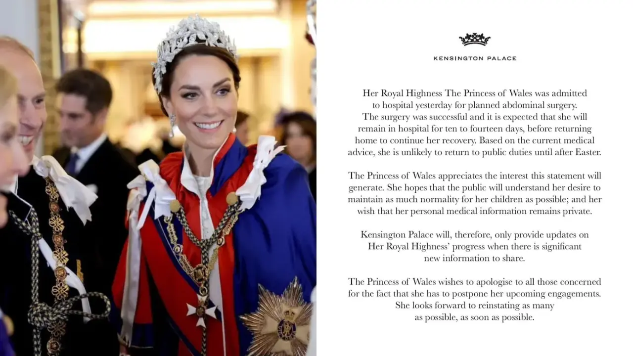 Kate Middleton Jalani Operasi Perut, Bakal Absen dari Tugas Kerajaan