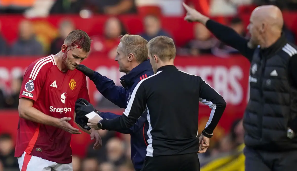 Pemain Manchester United, Matthijs de Ligt mendapatkan perawatan saat kepalanya mengalami pendarahan dalam laga lanjutan Liga Inggris 2024/2025 melawan Brentford di Old Trafford, Manchester, Sabtu (19/10/2024). (AP Photo/Dave Thompson)