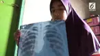 Seorang siswi di Sumedang tidak sengaja menelang jarum pentul.