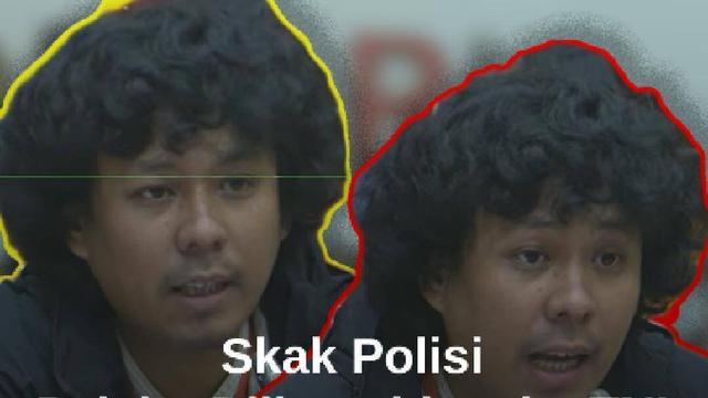 Komisi III DPR menggelar rapat bersama Kapolda Metro Jaya Irjen Asep Edi Suheri terkait kasus penyiraman air keras terhadap aktivis KontraS, Andrie Yunus, di Kompleks Parlemen, Jakarta, Selasa (31/3/2026). Koordinator KontraS Dimas Bagus Arya menilai peristiwa tersebut sebagai dugaan percobaan pe...