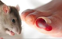 Ramai Kabar Warga Solo Meninggal akibat Leptospirosis, Ini Penjelasan Dinkes