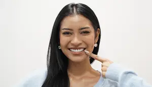 Puteri Indonesia 2026 Agnes Rahajeng Ungkap Alasan Pasang Veneer Gigi, Bukan Semata Estetika