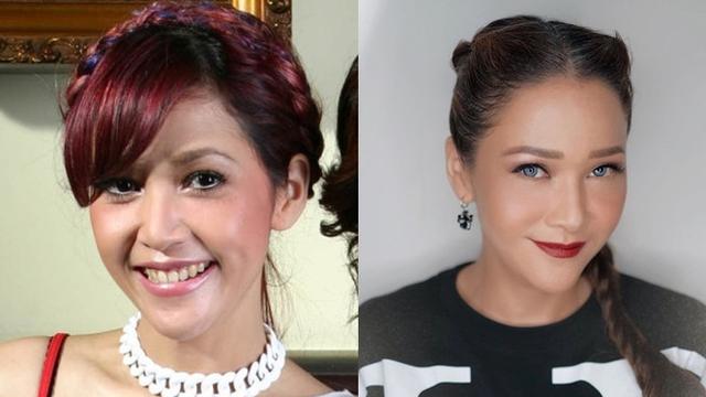 Potret Penyanyi Cantik Sebelum dan Sesudah Tanam Benang