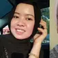 Sempat Disangka Terkena Guna-Guna, Wajah Wanita Ini Berubah Jerawatan Parah (Sumber: mStar)