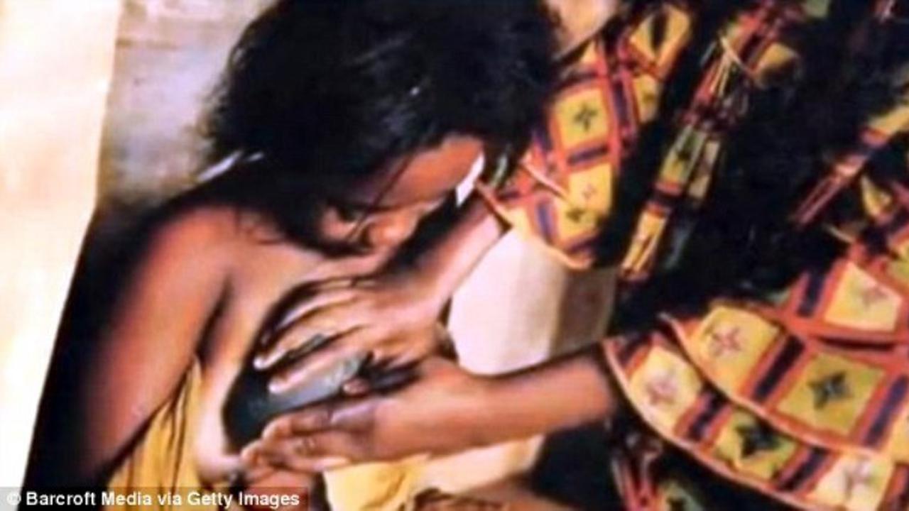 Ritual Setrika Payudara di Kamerun Bikin Merinding