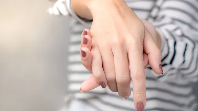 15 Cara Mengatasi Kulit Terbakar Matahari, Kembalikan Glowing Alami dengan Efektif