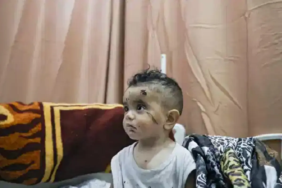Potret anak Palestina yang menjadi korban akibat serangan Israel (AFP)