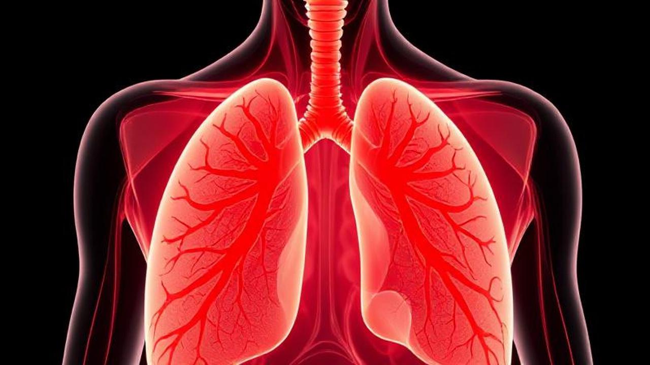 Begini Kondisi Paru-Paru Saat Terserang Pneumonia Menurut Dokter