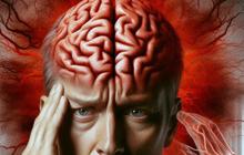 Risiko Stroke Hemoragik Seperti yang Dialami Ibrahim Assegaf Mengintai Pasca COVID-19, Akibat Long Covid atau Vaksin mRNA?