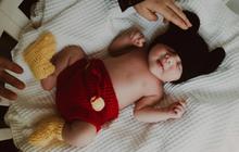Kasus Daycare Little Aresha, Dokter Ungkap Bahaya Mengikat Kaki Bayi